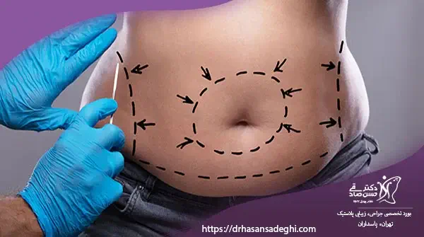 necessary-preparations-before-body-contouring